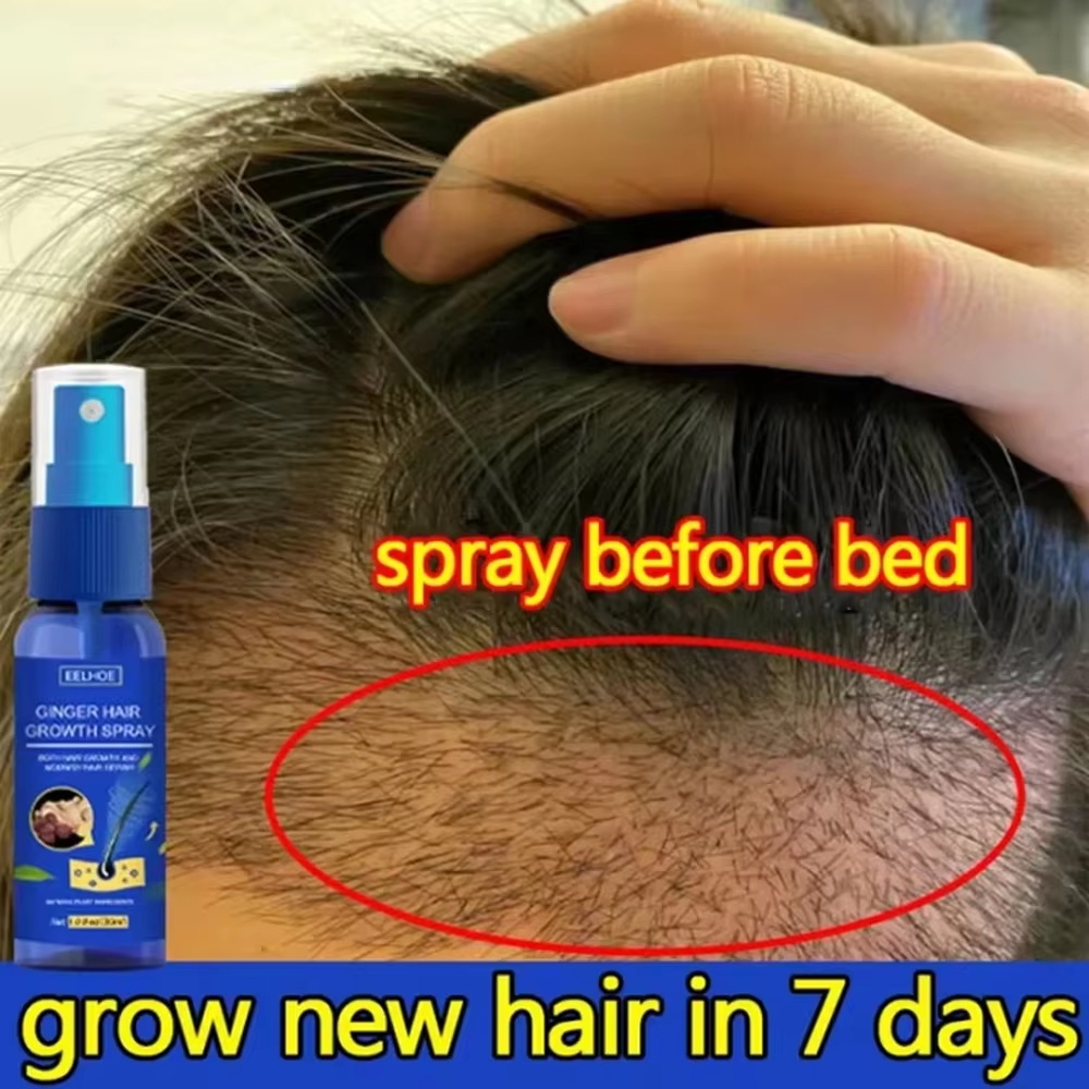 Hair Care Products - Schnelles Ingwer-Haarwuchsspray für Wurzelwachstum, Anti-Haarausfall, Haarwuchs-Serum,
